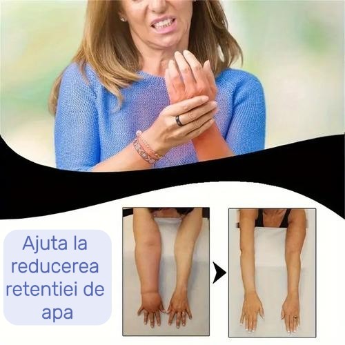 Inel MagneticFit - inel terapeutic pentru slăbire