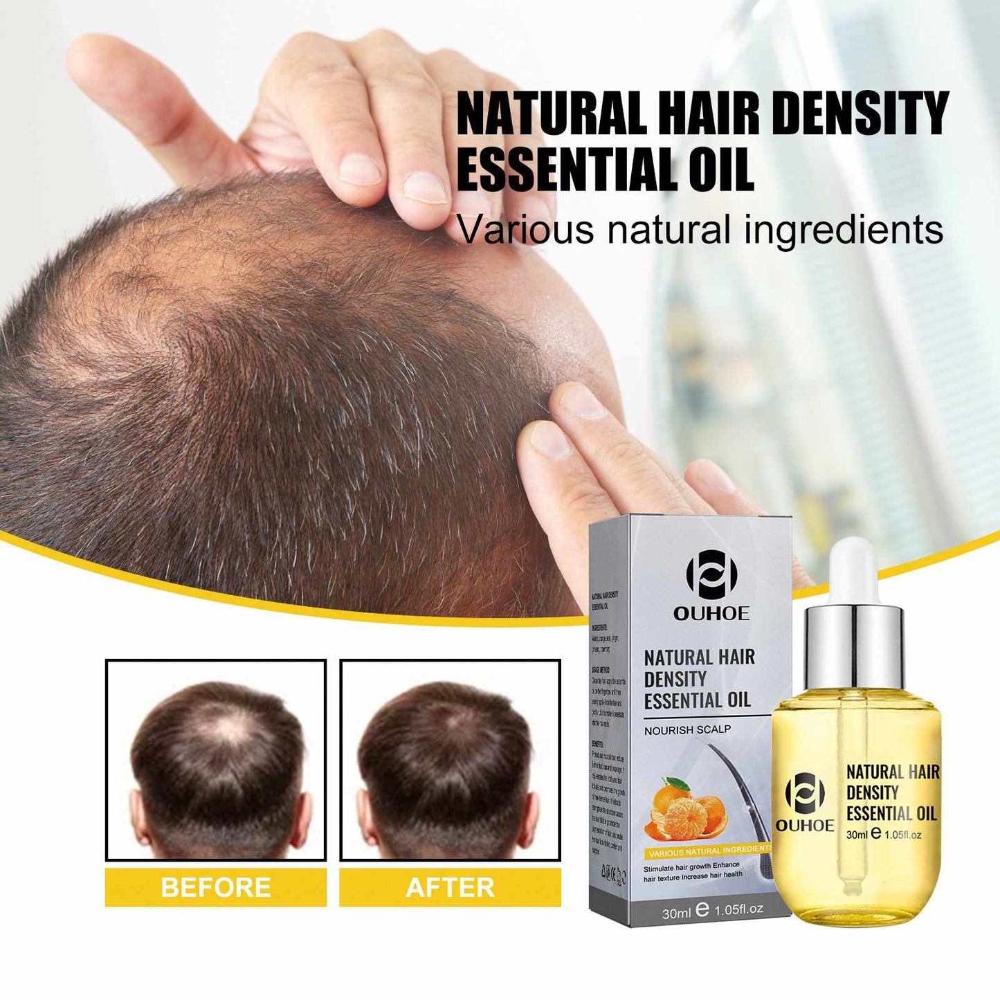 Gel natural pentru stimularea cresterii parului
