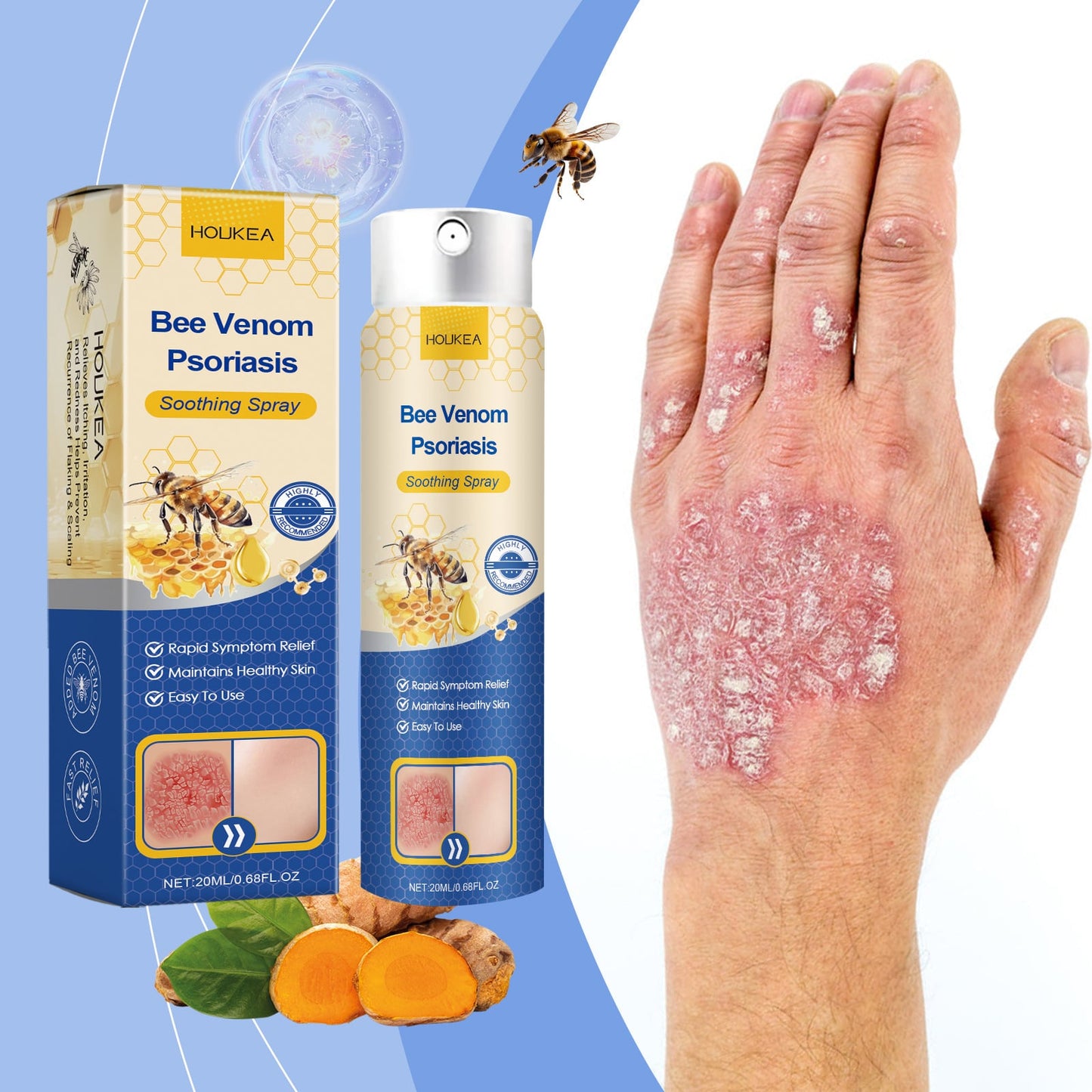 BeeCalm - Spray pentru psoriazis, roseata si mancarime