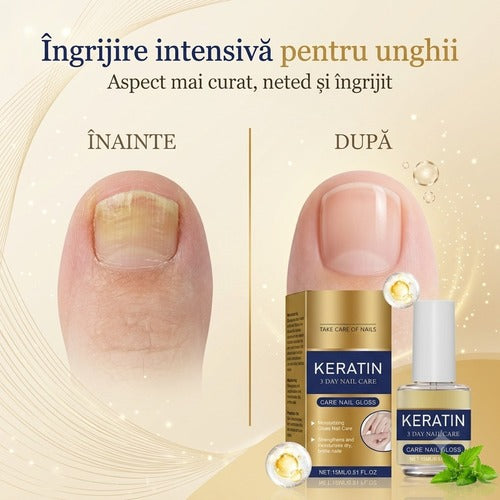 KeraForte - ulei pentru tratarea unghiilor cu ciuperca sau incarnate