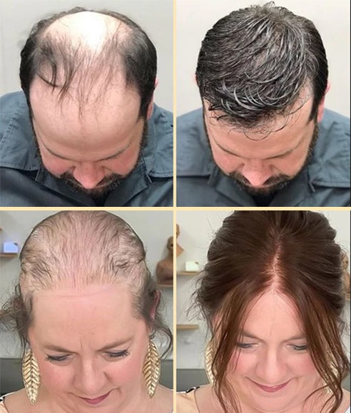 Gel natural pentru stimularea cresterii parului